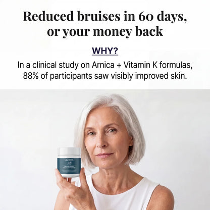Livara: Finally, A Cream That Fades Bruises On Fragile Skin